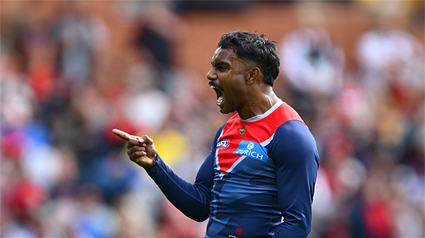 VOTES: Rd 05 vs Essendon